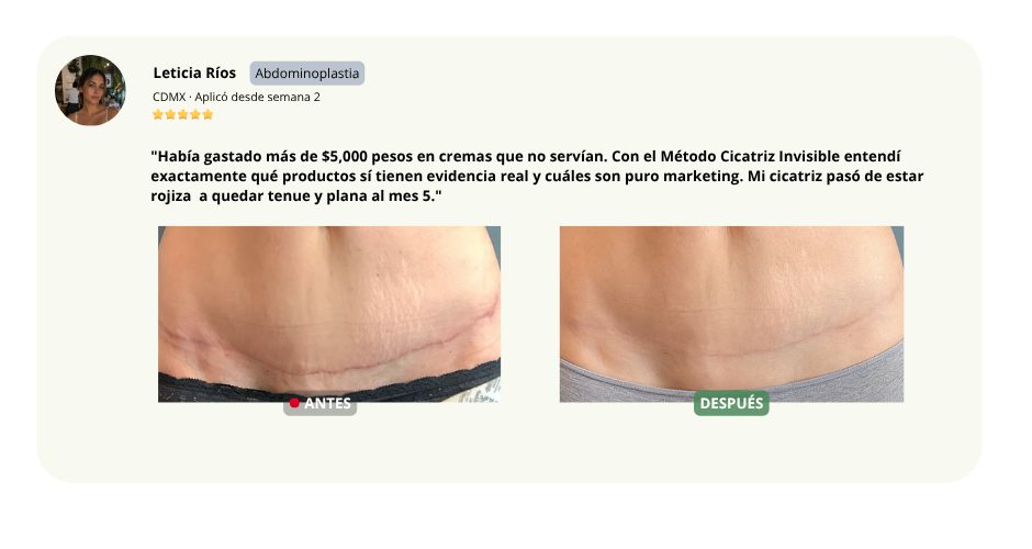 Testimonio de Leticia Ríos — Abdominoplastia